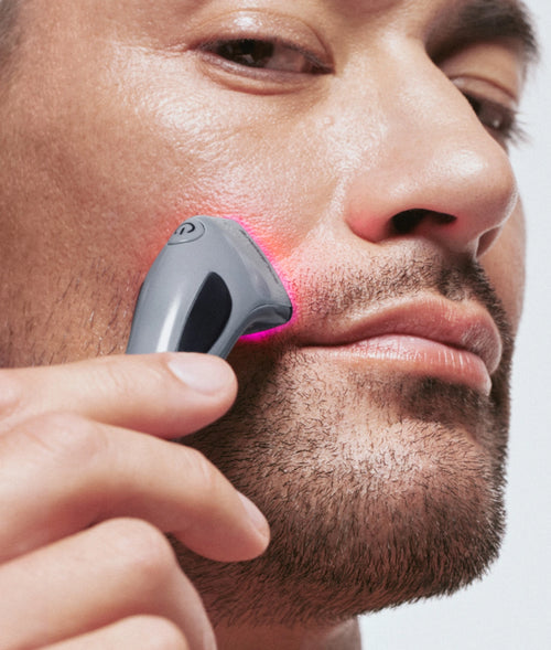 terapia de luz vermelha para a acne